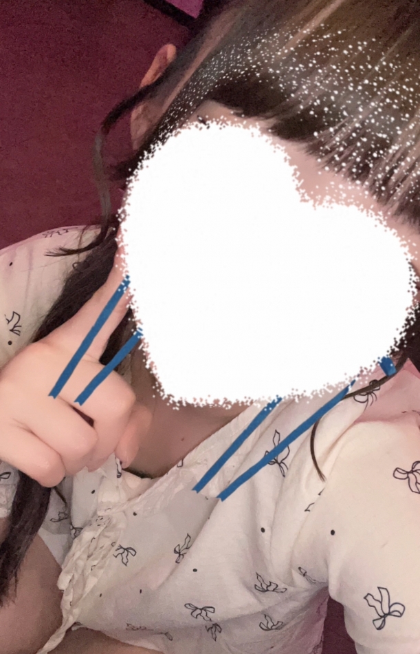 結膜炎なった～😭