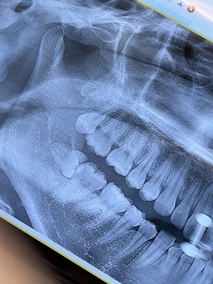 口の中フェチの人用