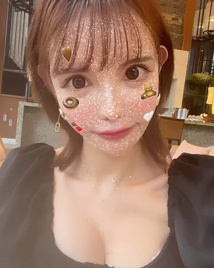 #ダウンタイム #ベイビーおでこ #額脂肪注入 
※グロ画像無理な方は三枚目見ないでください。
.
.
病院や先生、ビフォーアフターはまたレポするね😉
.
.
.
ダウンタイムに沖縄です☔️
六日目にして目が腫れてきたのと載せるもんなくて、
初めてフィルターで撮ったの載せてみたww
.
.
はやくお店にも復活したい😙💪✨
.
.
.
.
.
.
.
.
.
#ショート女子 
#シャンパンタワー
#クリュッグ 
#ソウメイ 
#キャバ嬢 
#新宿キャバクラ 
#新宿キャバ嬢 
#歌舞伎町 
#新宿 #六本木