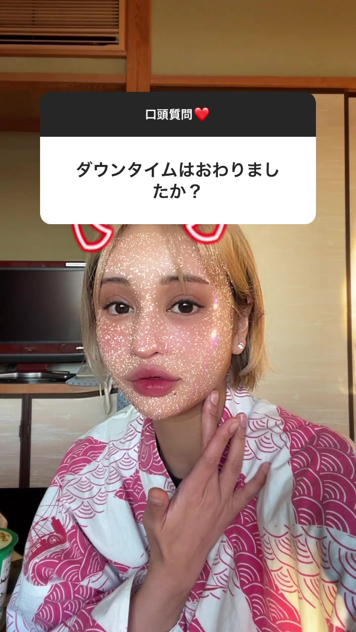 腫れが引いたからダウンタイム終了ではないのよ。#ダウンタイム# インスタストーリー#口頭質問返し#桜井野の花