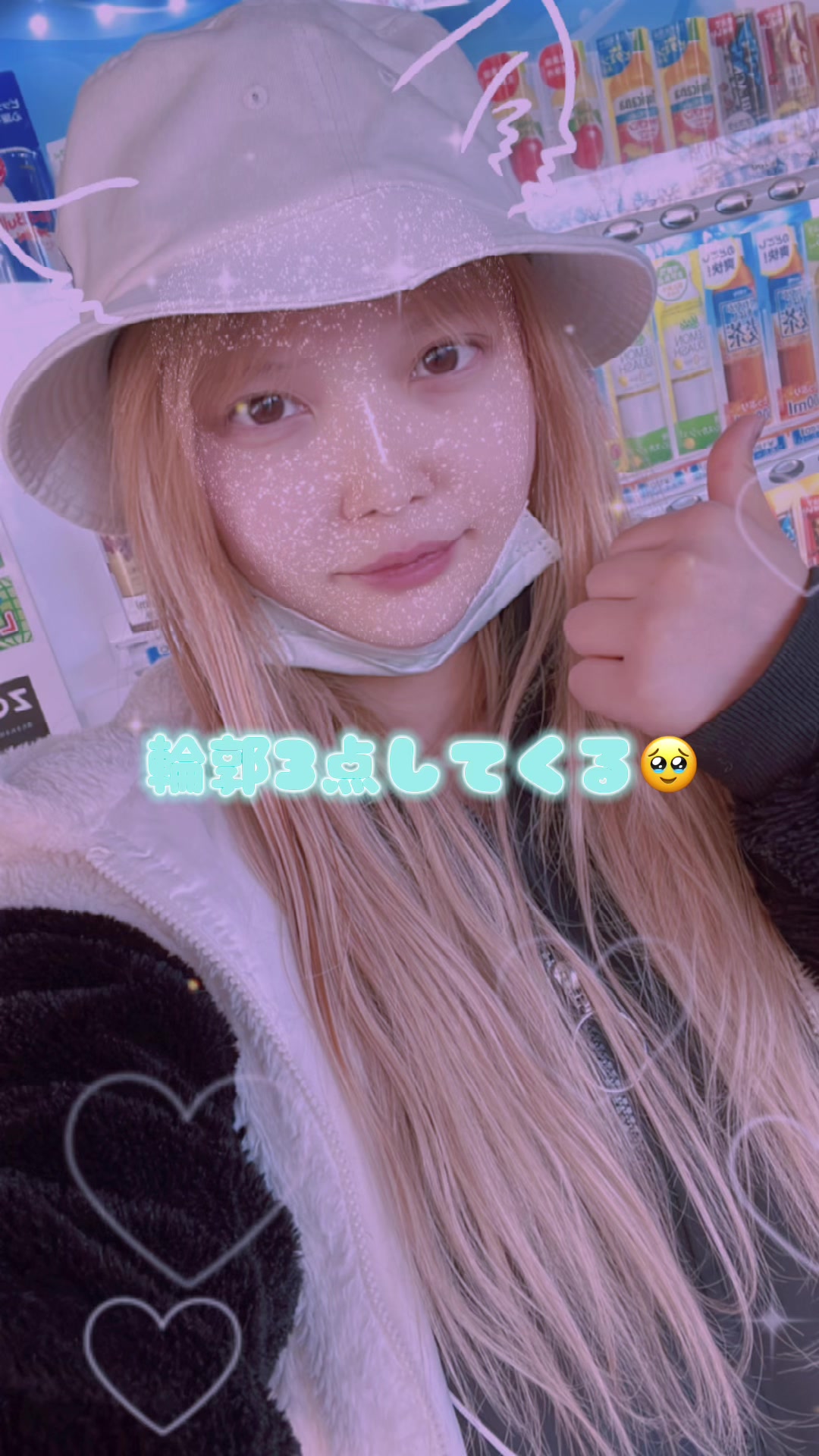 初の整形。土台からって聞いたから輪郭3点と脂肪吸引してきた。浮腫みすぎて顔パンパン#おすすめ #fyp #運営さん大好き #整形 #脂肪吸引 #輪郭3点 #地雷女子