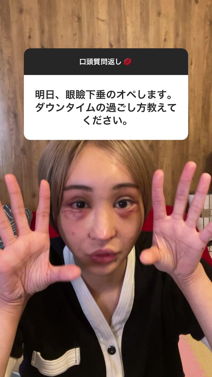 ダウンタイムの事なら私に聞いて❤️#インスタグラム#ストーリーズ#切り取り#整形#ダウンタイム#眼瞼下垂#桜井野の花