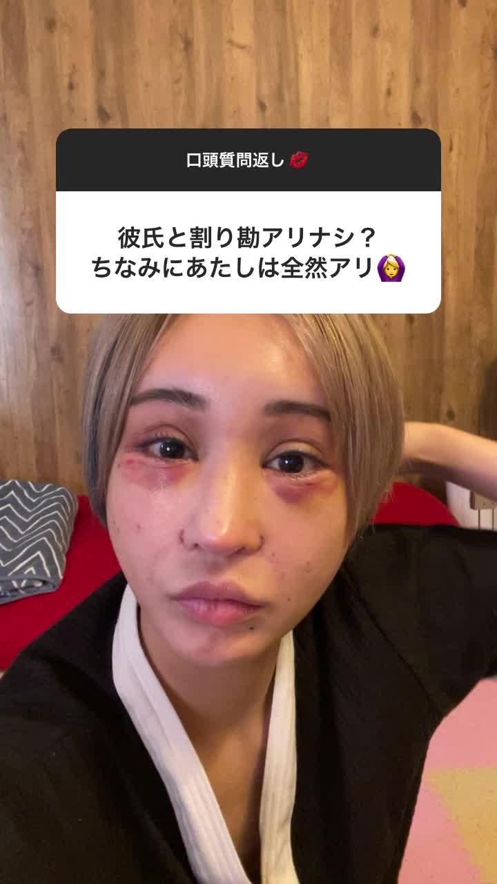 経済力ある方が払えばよくない？男が出さなきゃいけない理論言ってる女の人とかめちゃくちゃくだらないし、考え古い。昭和かよ。#インスタグラム#ストーリーズ#切り取り#整形#ダウンタイム