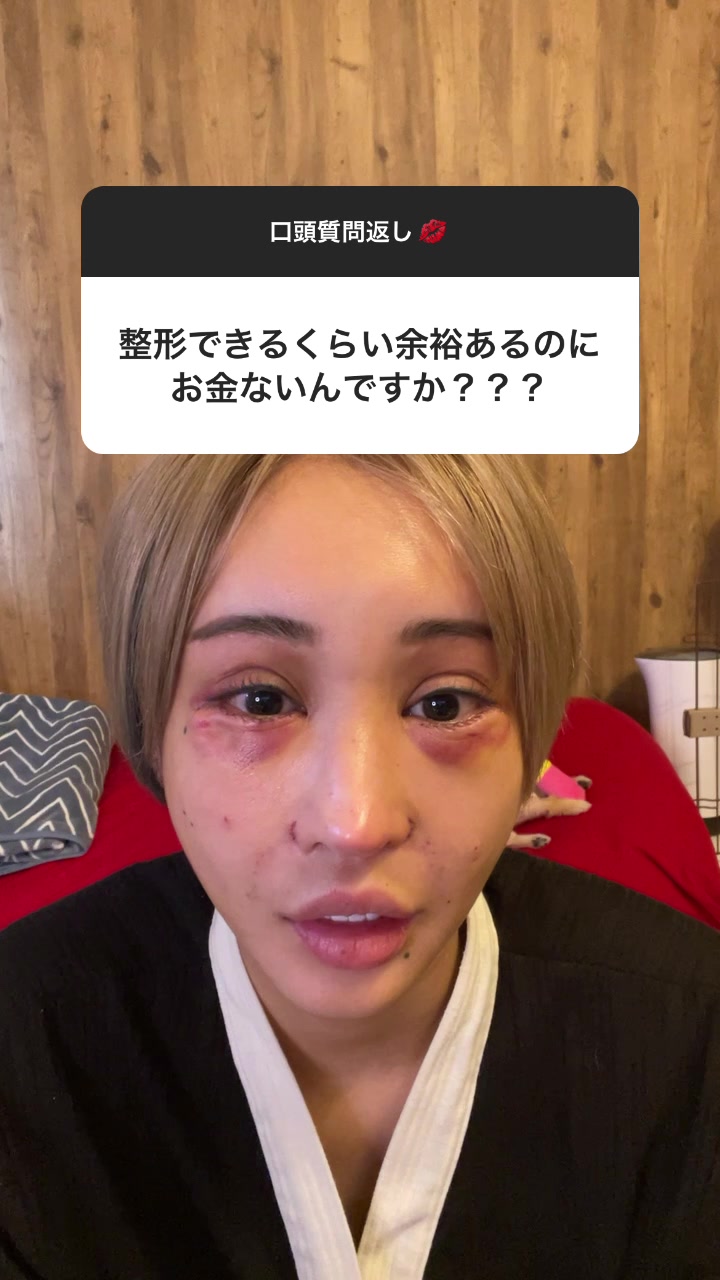 お金は昔程は持ってないです！そのお金の行き先は全て国なので、日本がいいお金、税金の使い方をしてくれると嬉しいです。#美容整形##整形#裏ハムラ#涙袋形成#税金