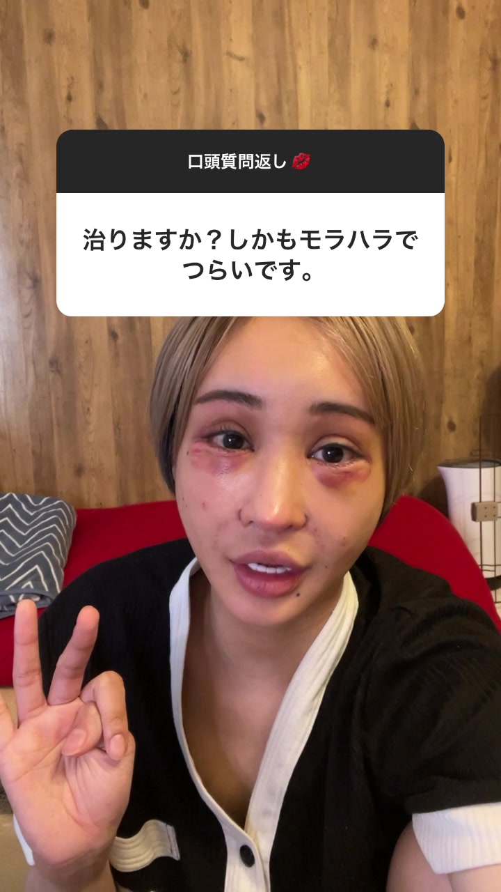 要は治らない。なので自分が我慢するもしくは来世でまた出逢うの２択になります。#インスタグラム#ストーリー#口頭質問返し#モラハラ#桜井野の花