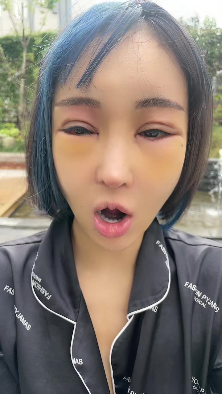 友達いない人用フィルター(^^)v 次回は友達と撮りたいので、友達になってくれる人いませんか？ #我姓石 #dance #整形 #ダウンタイム #骨切り #桜井野の花 #歌舞伎町 #キャバ嬢 #キャバクラ