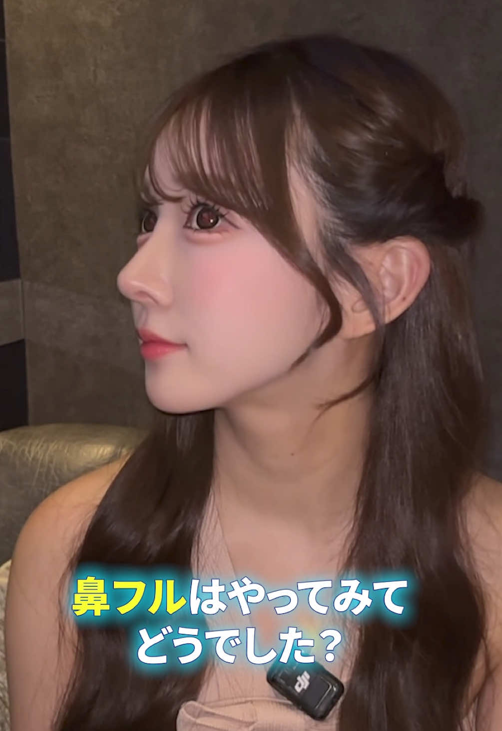 鼻フル再手術から約5ヶ月👃 鼻整形ってしんどいよね...🥲 でも今の鼻最高!!!!♡ #キャバ嬢 #美容 #整形