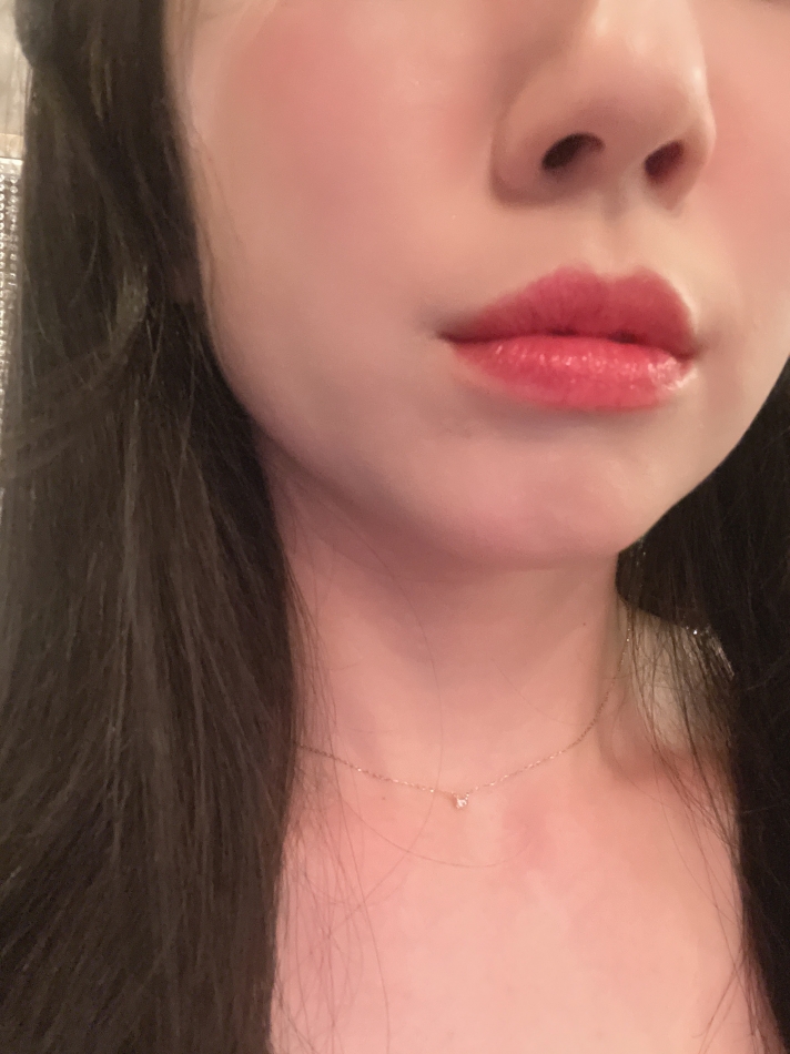 春の肌荒れ中🌸