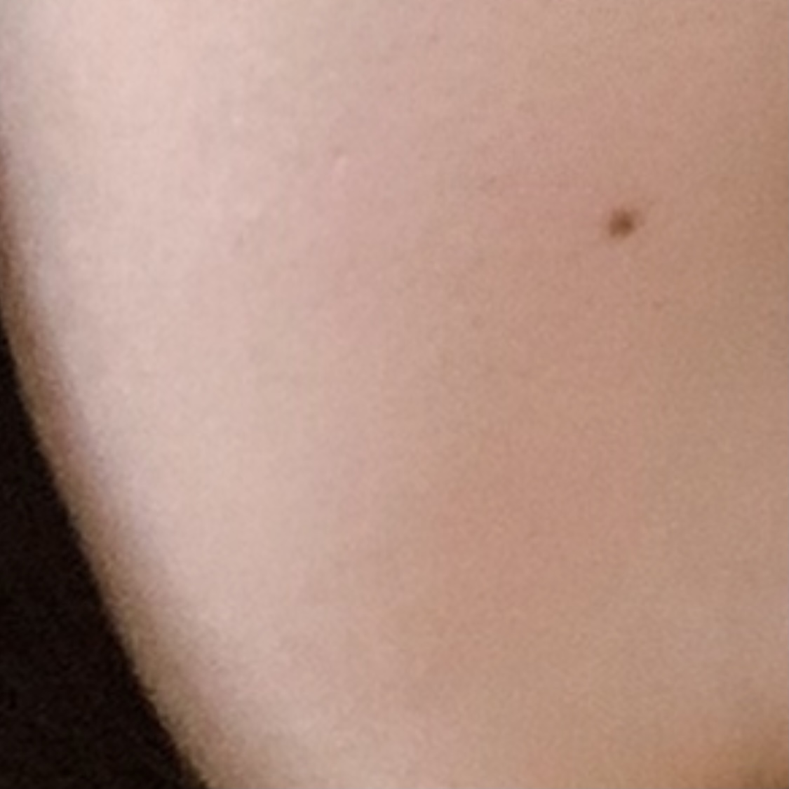 今日のほくろ