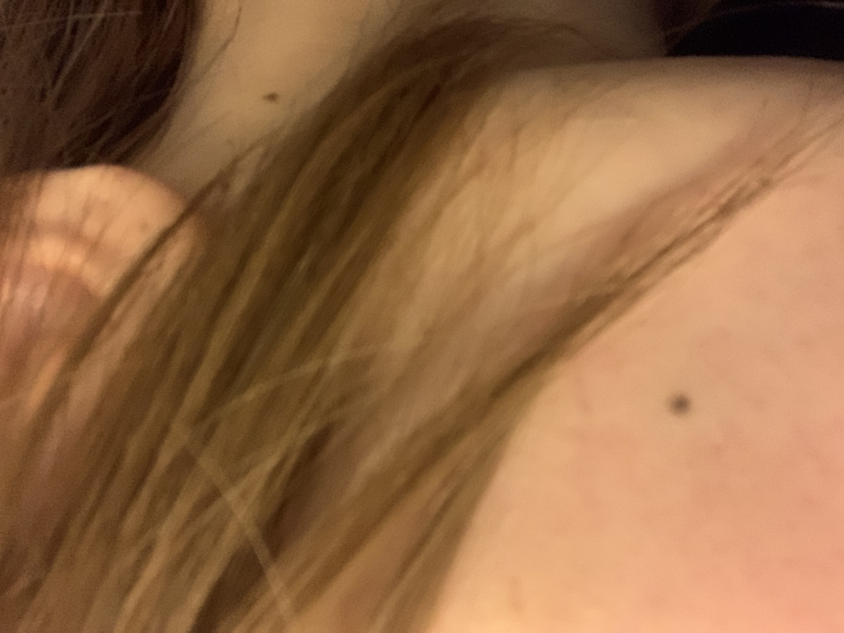 今日のほくろ