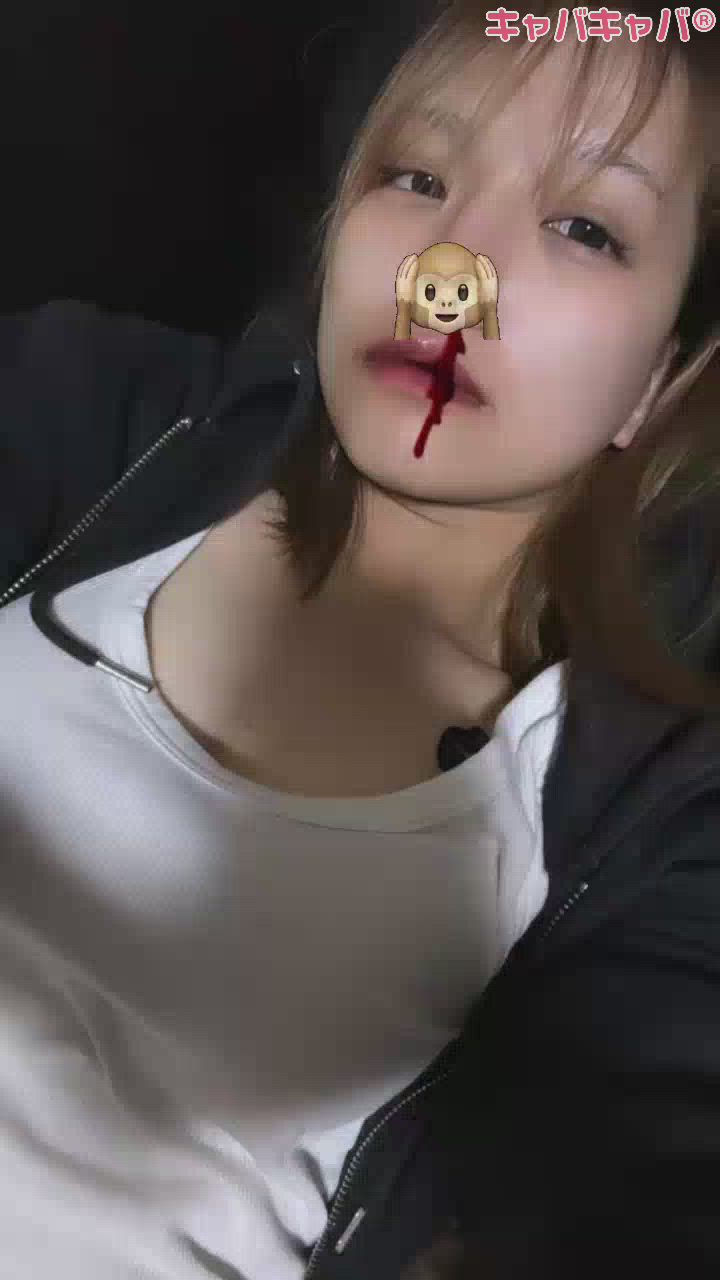 喉と鼻からくる風邪にはなんだっけ？